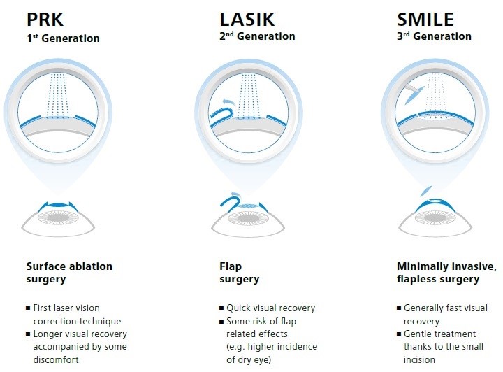 Prima Saigon: Laser refractive surgery for <yoastmark class=