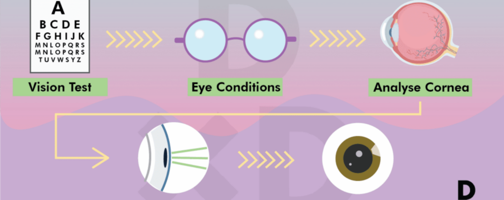 Prima Saigon: Bác sĩ của bạn sẽ kiểm tra sự hiện diện của bất kỳ bệnh mắt nào và xác định mức độ phù hợp của bạn với cuộc phẫu thuật. 