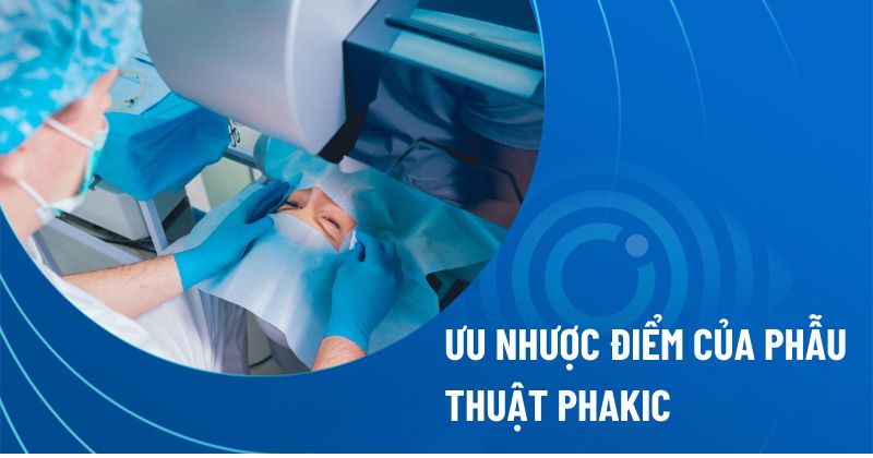 Bệnh viện Mắt Prima Sài Gòn: Ưu nhược điểm phẫu thuật Lasik